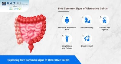 Exploring Five Common Signs of Ulcerative Colitis