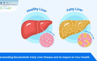 Understanding Nonalcoholic Fatty Liver Disease and Its Impact on Your Health