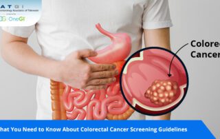 Colorectal Cancer Screening Guidelines