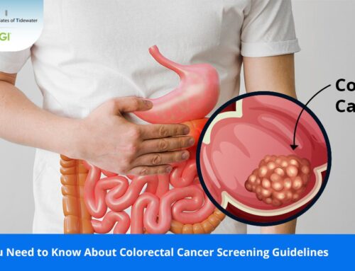 What You Need to Know About Colorectal Cancer Screening Guidelines