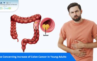 The Concerning Increase of Colon Cancer in Young Adults