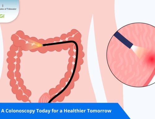 Schedule A Colonoscopy Today for a Healthier Tomorrow