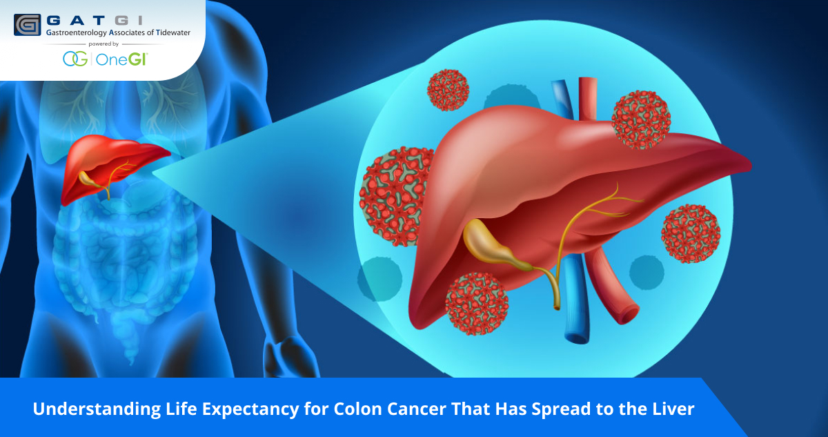 Colon Cancer Spread to Liver Life Expectancy