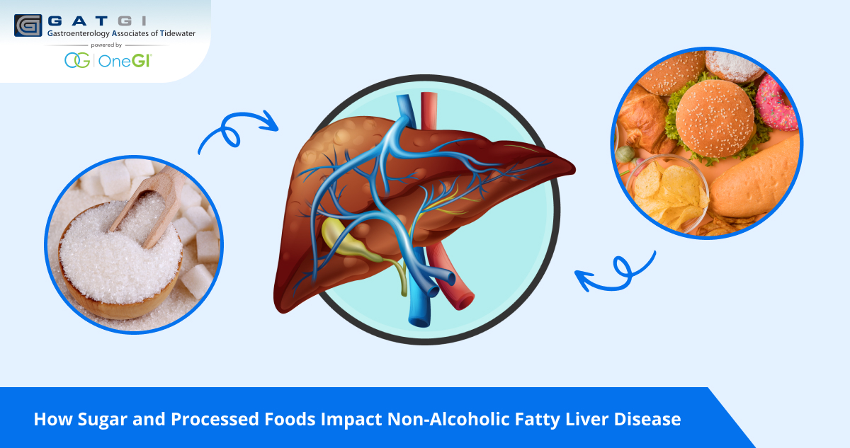 How Sugar and Processed Foods Impact Non-Alcoholic Fatty Liver Disease