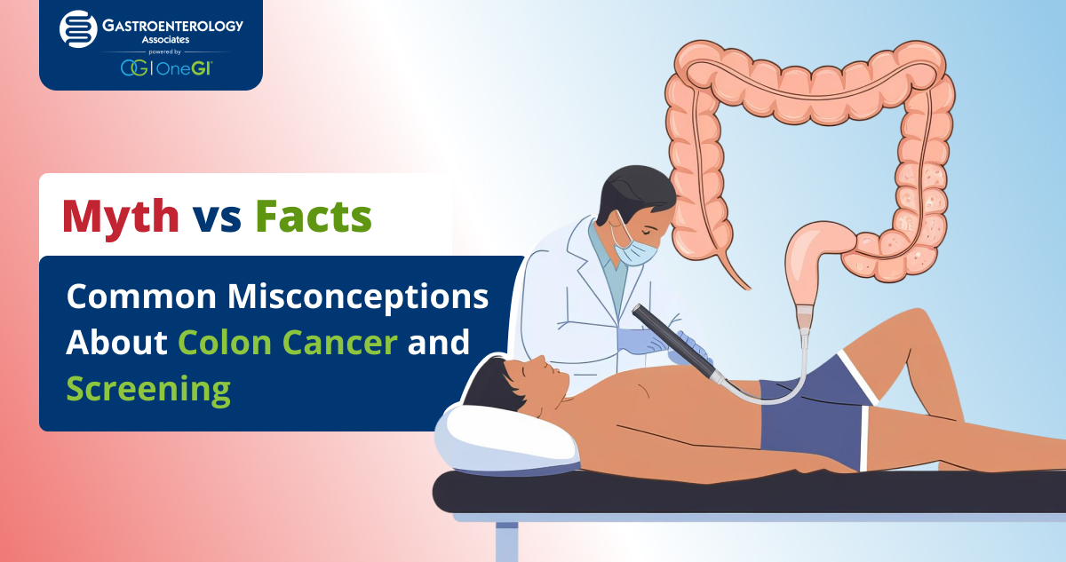 colon cancer myths vs facts